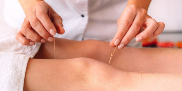 does acupuncture help with fertility