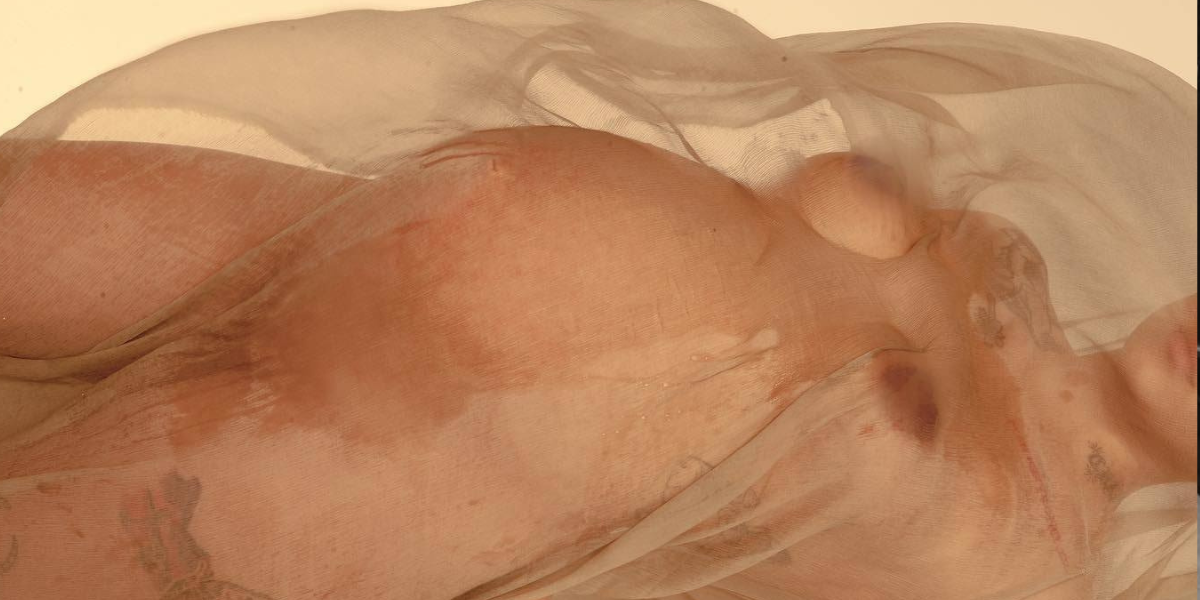 gestational diabetes risks