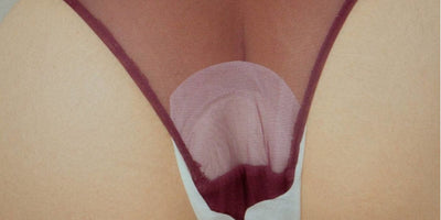 Is it normal to bleed during or after sex?