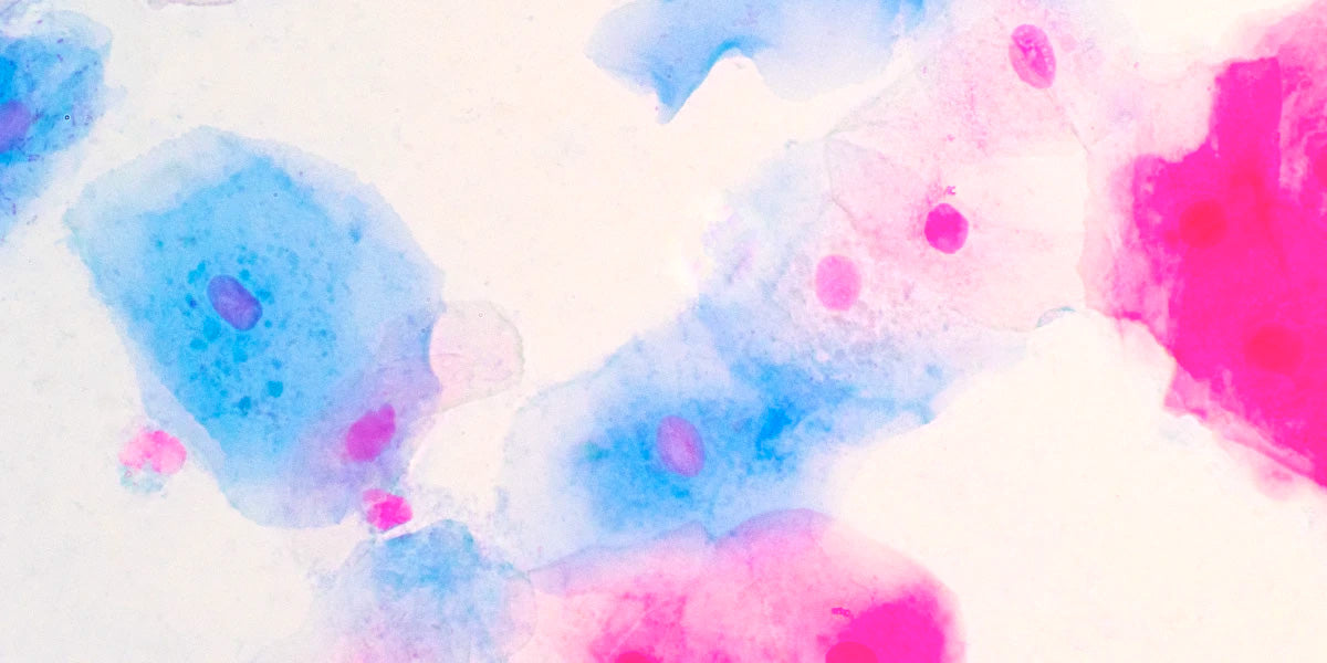 What does an abnormal pap smear mean?